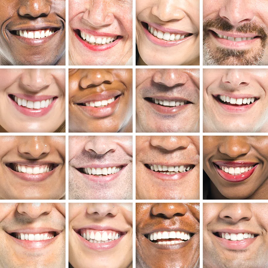 teeth whitening Asheville NC