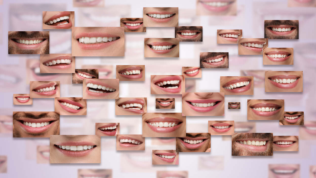 smiling people with perfect white teeth